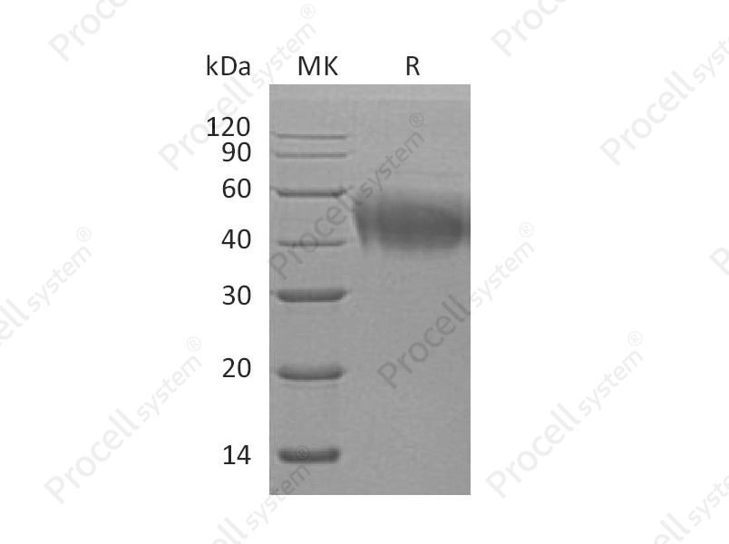 IL-4R&alpha;/CD124 (C-6His), Human, Recombinant