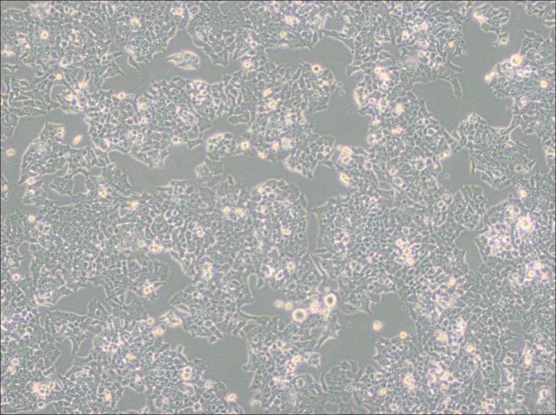 NCI-H520 Cell Complete Medium - 3