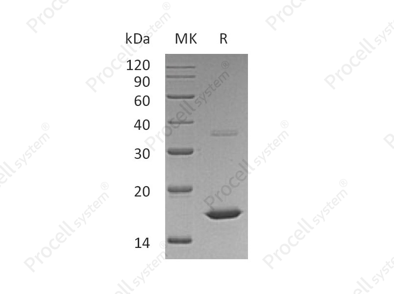 FGF-2/bFGF/FGF-b (Met134-Ser288), Human, Recombinant
