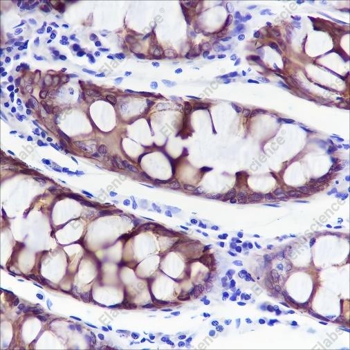 Recombinant Keratin 20 Monoclonal Antibody - 2