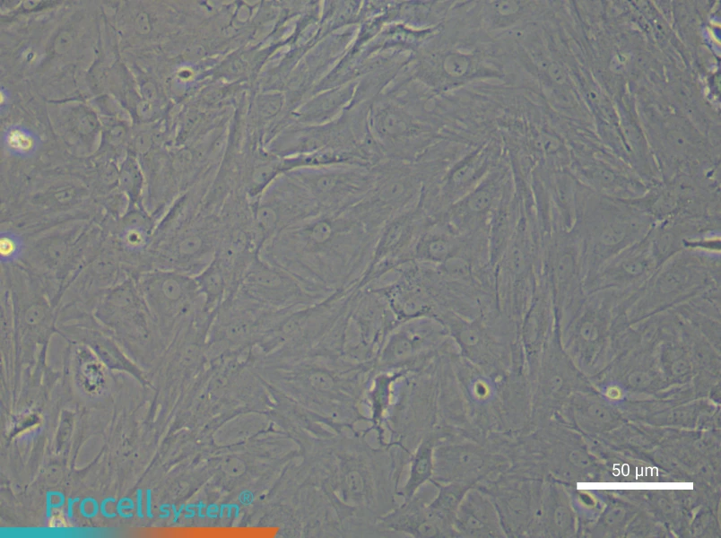 Rat Retinal Muller Cell Complete Medium - 5