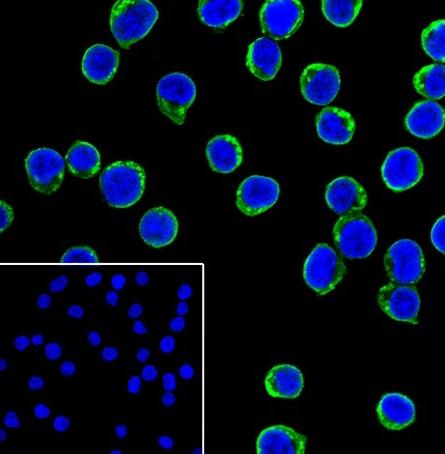 Recombinant Tec Monoclonal Antibody - small - 5