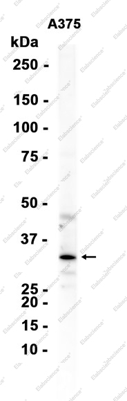 Recombinant MC1-R Monoclonal Antibody - 1