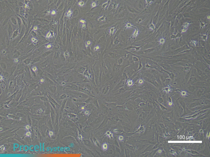 Rat Retinal Muller Cell Complete Medium - 3