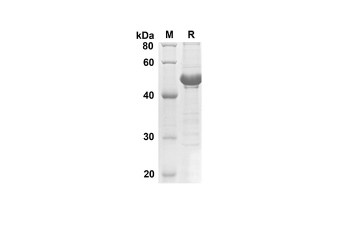 Recombinant Human CDH1 Protein(Sumo Tag)-1