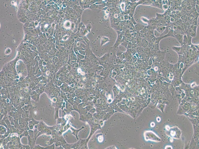 UPCI-SCC-090 Cell Complete Medium - small - 5