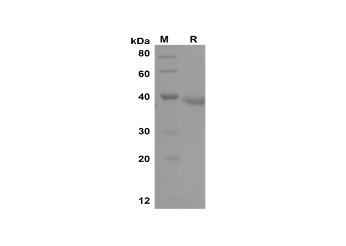 Recombinant Human CD38/SCARB3 Protein(His Tag)-产品推荐-1