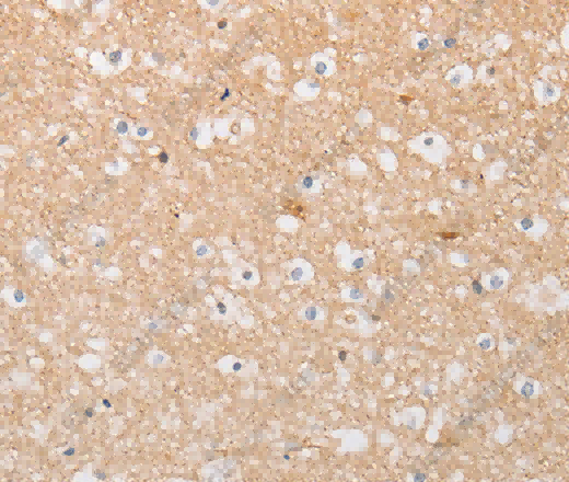 ATG9A Polyclonal Antibody - 2