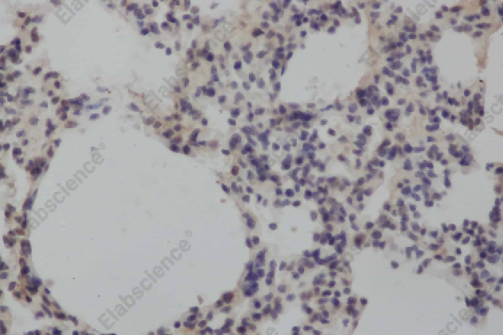 MMP8 Polyclonal Antibody - 2