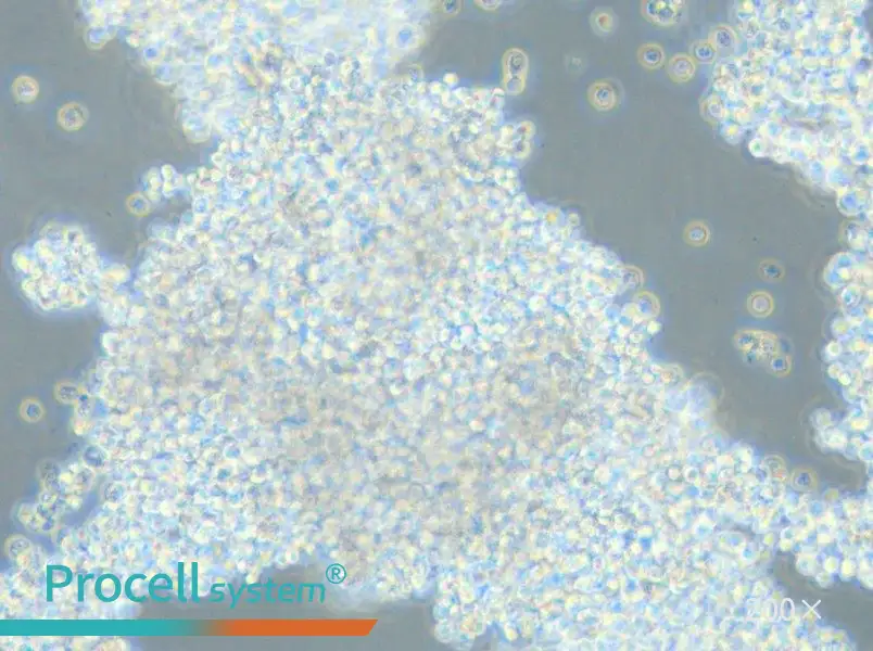 NCI-H2171 Cell Complete Medium - 6