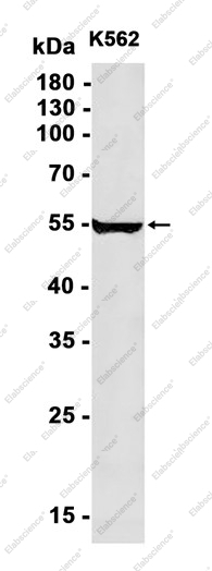 Recombinant Nuf2 Monoclonal Antibody - 1