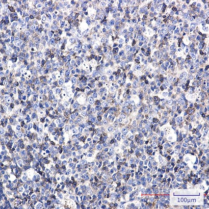 Recombinant CD50/ICAM-3 Monoclonal Antibody - 3