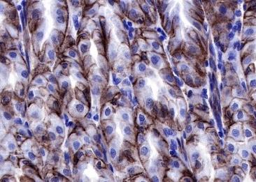 Recombinant Claudin 18.2 Monoclonal Antibody-searchlist-1