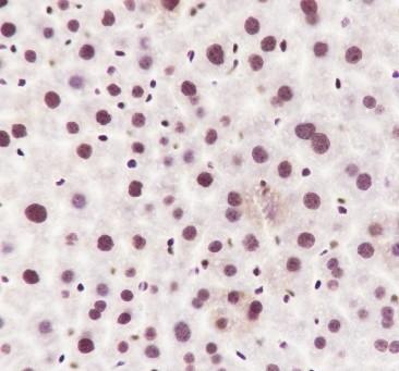 Recombinant ILF3 Monoclonal Antibody - small - 6