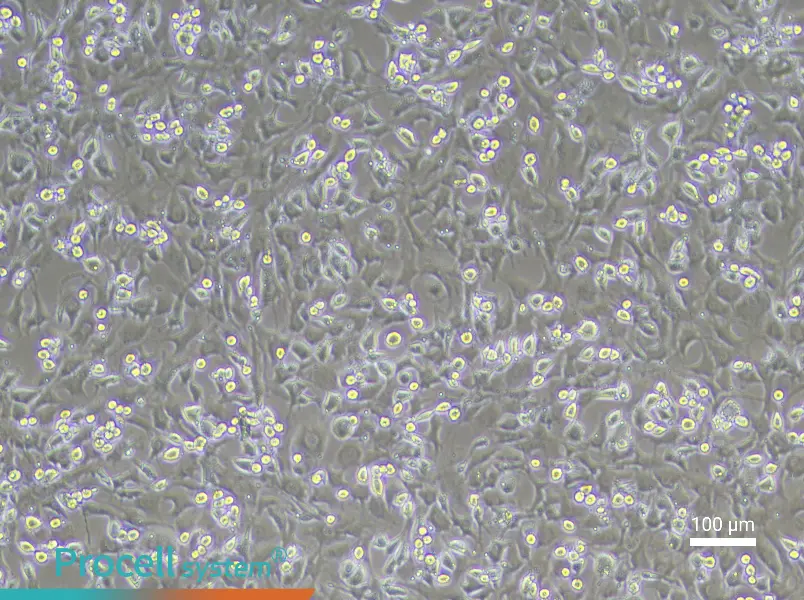 Mouse Intervertebral Disc Annulus Fibrosus Cell Complete Medium - 1