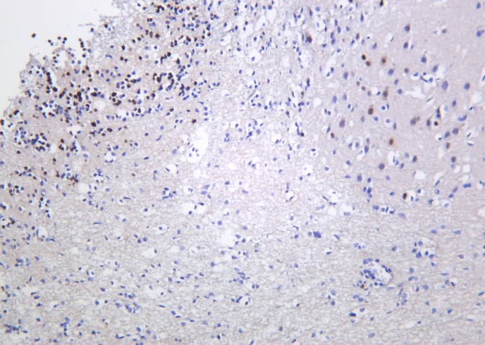 Recombinant Fos B Monoclonal Antibody-searchlist-1
