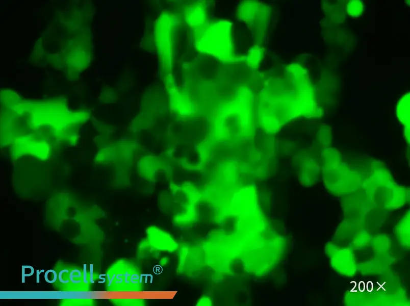 MCF7-LUC-EGFP Cell Complete Medium - small - 5