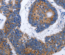 EEF1 gamma Polyclonal Antibody - 2