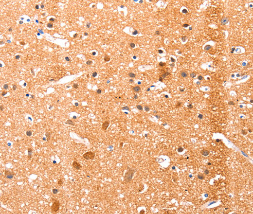 Immunohistochemistry of paraffin-embedded Human brain tissue using Ephrin A1 Polyclonal Antibody at dilution 1:51