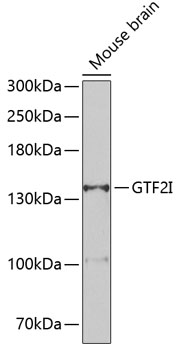 Western blot analysis of extracts of mouse brain using GTF2I Polyclonal Antibody at 1:500 dilution.