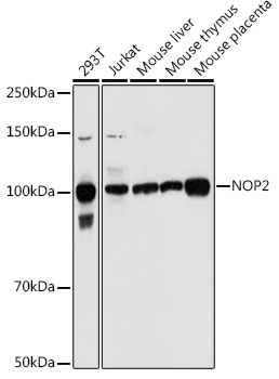 Western blot analysis of extracts of various cell lines using NOP2 Polyclonal Antibody at 1:1000 dilution.