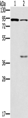 Western Blot analysis of Mouse kidney and brain tissue using CNGA3 Polyclonal Antibody at dilution of 1:500