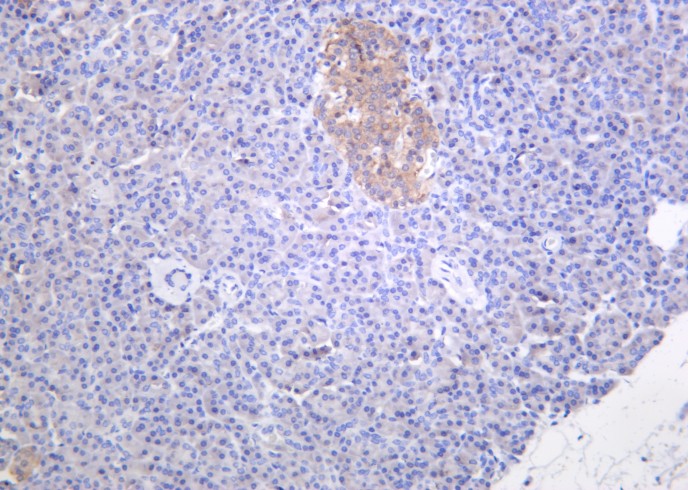 Recombinant Musashi-1 Monoclonal Antibody-searchlist-1