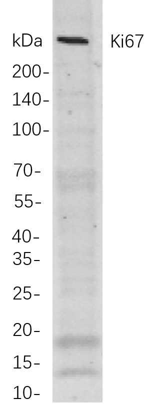 Recombinant Ki67 Monoclonal Antibody-searchlist-1