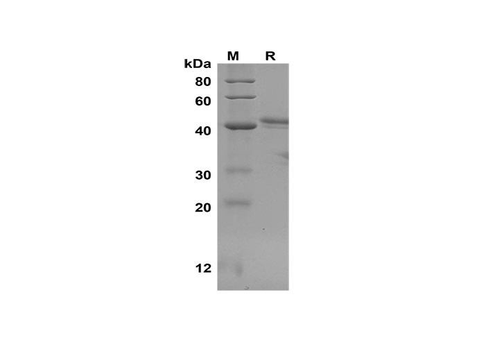 Recombinant Human TGFβ1 Protein-产品推荐-1