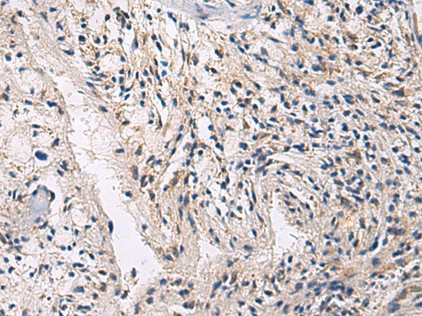 Immunohistochemistry of paraffin-embedded Human brain tissue  using CEP89 Polyclonal Antibody at dilution of 1:100(?200)