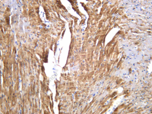 Recombinant PLB Monoclonal Antibody - 2