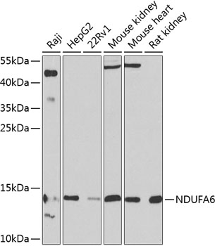 Western blot analysis of extracts of various cell lines using NDUFA6 Polyclonal Antibody at 1:1000 dilution.