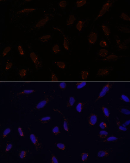 Immunofluorescence analysis of U-2 OS cells using ACAT1 Polyclonal Antibody at dilution of 1:100. Blue: DAPI for nuclear staining.