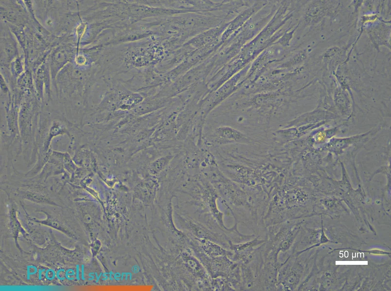 Mouse Bladder Smooth Muscle Cell Complete Medium - 6