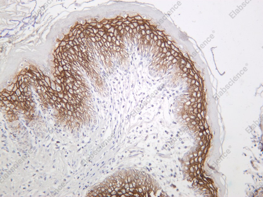 Recombinant Claudin-1 Monoclonal Antibody - 5
