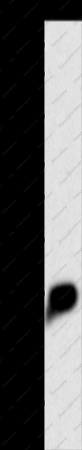 CRP Polyclonal Antibody - 1
