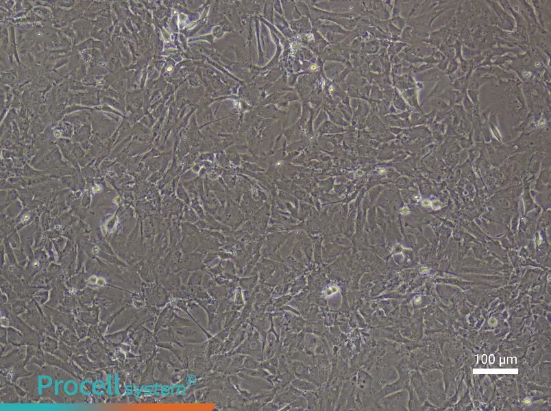 Rat Pulmonary Artery Fibroblast Complete Medium - 2