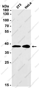 Recombinant UCH37 Monoclonal Antibody - 1