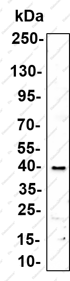 Recombinant Haptoglobin Monoclonal Antibody - 4