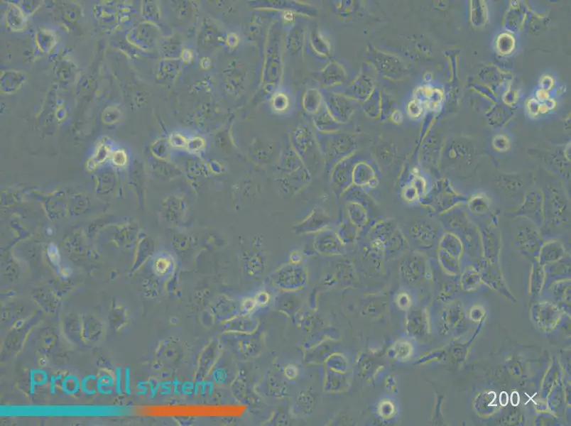 IGROV-1 Cell Complete Medium - 6