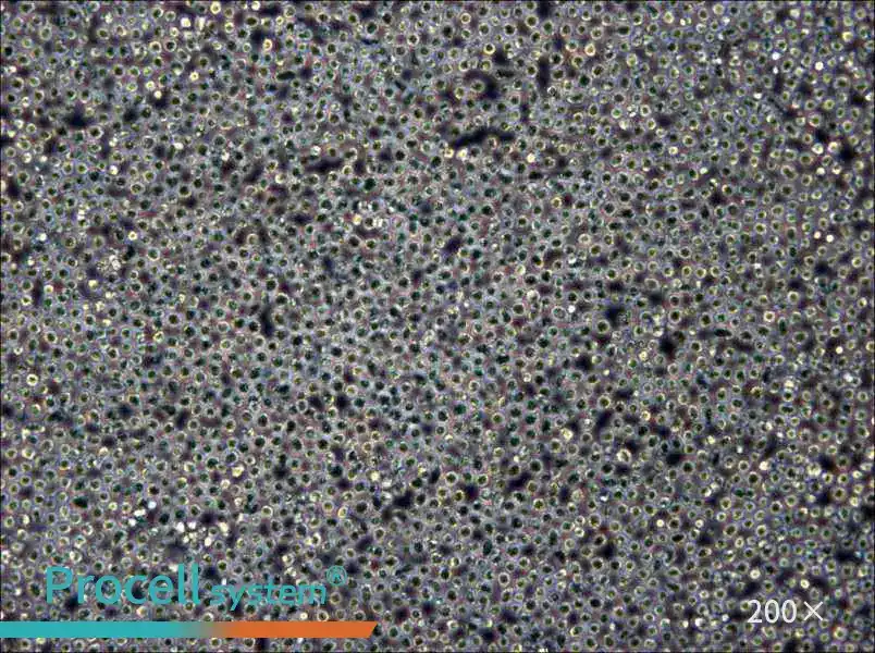 Z-138 Cell Complete Medium - 5