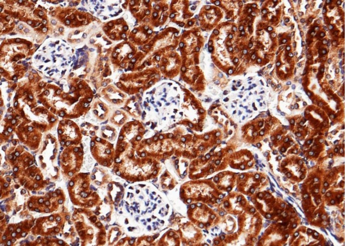 Recombinant LRPAP1 Monoclonal Antibody - small - 2