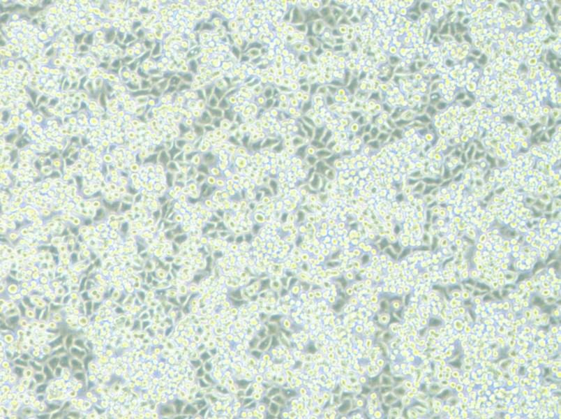 NCI-H2122 Cell Complete Medium - 8