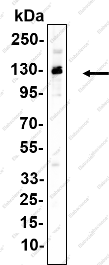 Recombinant Fibrinogen alpha chain Monoclonal Antibody - 1