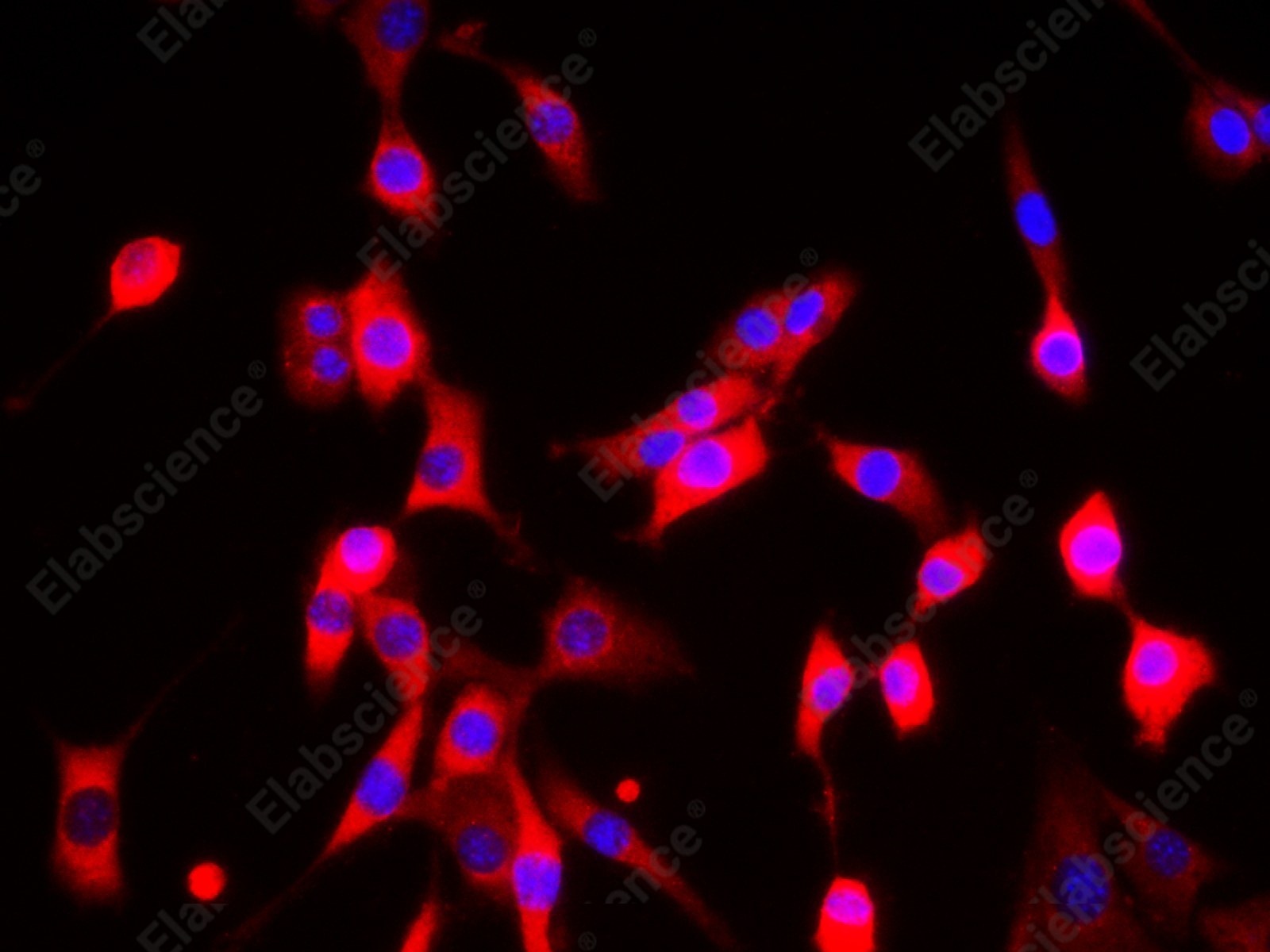EEF2 Polyclonal Antibody - 8