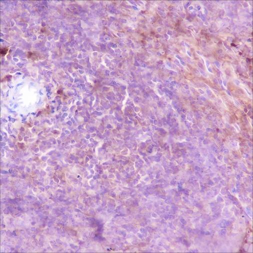 Recombinant VPAC2 Monoclonal Antibody - small - 2