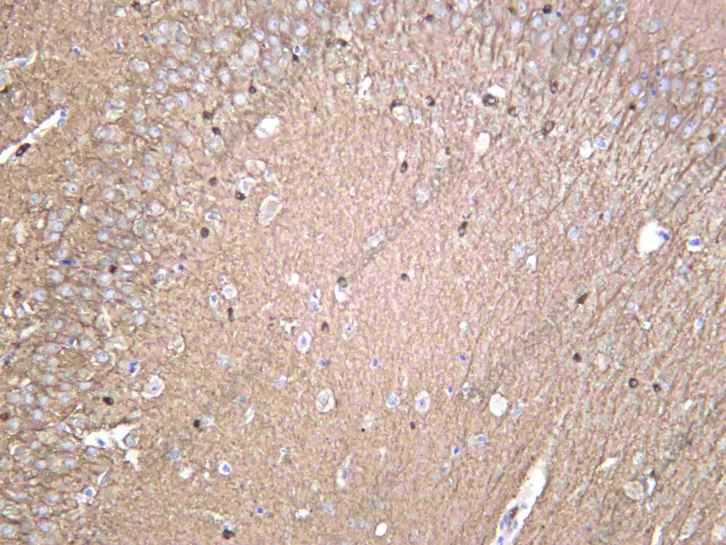 Recombinant TBB4A Monoclonal Antibody - 3