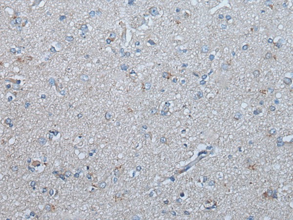 Immunohistochemistry of paraffin-embedded Human brain tissue  using UBR4 Polyclonal Antibody at dilution of 1:65(?200)