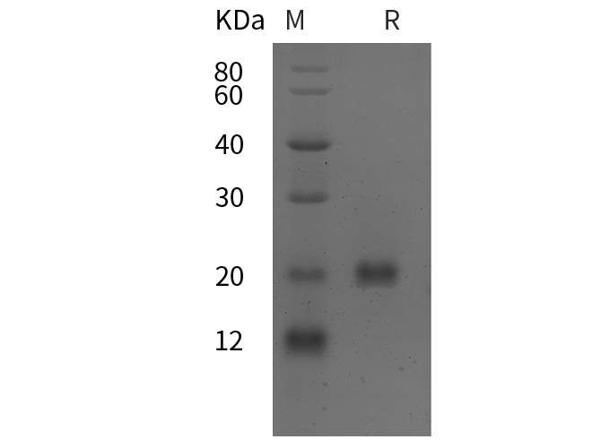 Recombinant Mouse TNF-α Protein(GST Tag)-产品推荐-1