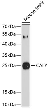 Western blot analysis of extracts of mouse testis using CALY Polyclonal Antibody at 1:1000 dilution.